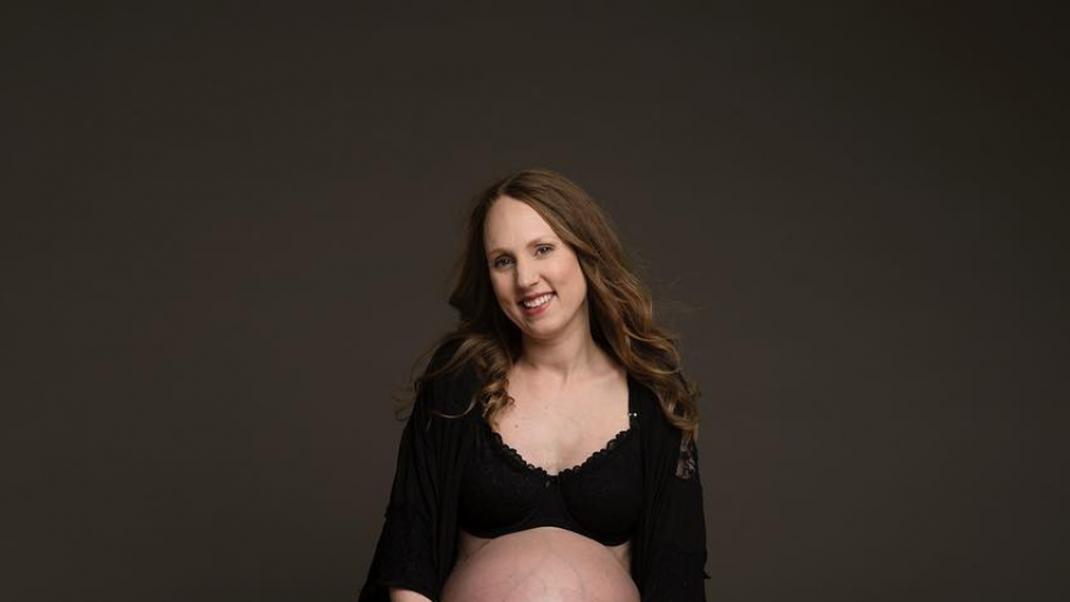 Έγκυος σε τρίδυμα -Πώς η υπερβολικά μεγάλη κοιλιά αυτής της 36χρονης την έκανε το πιο viral πρόσωπο του Internet | 0 bovary.gr