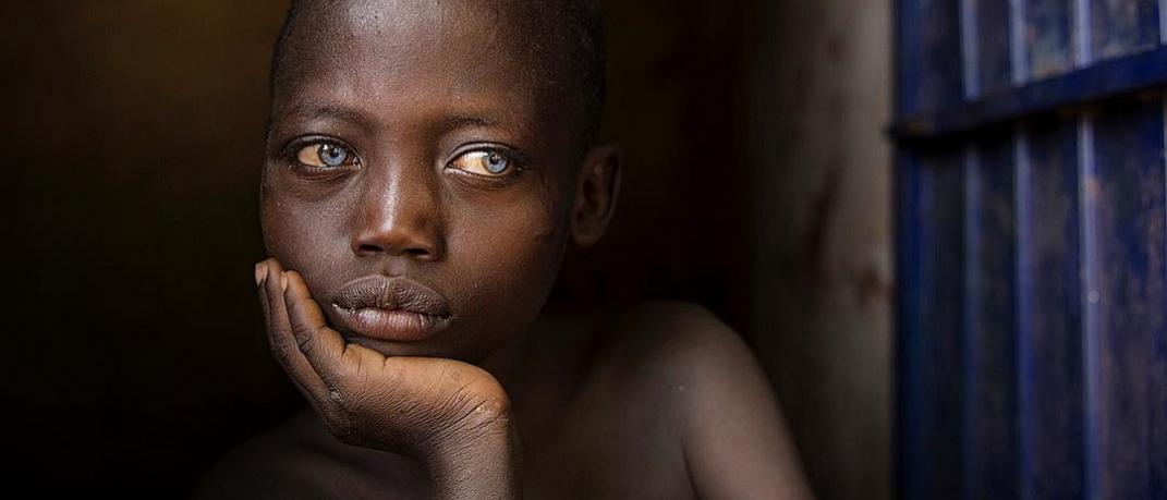 παιδί από το Νότιο Σουδάν