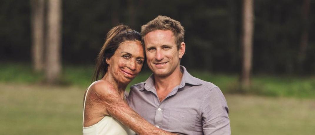 turia pitt