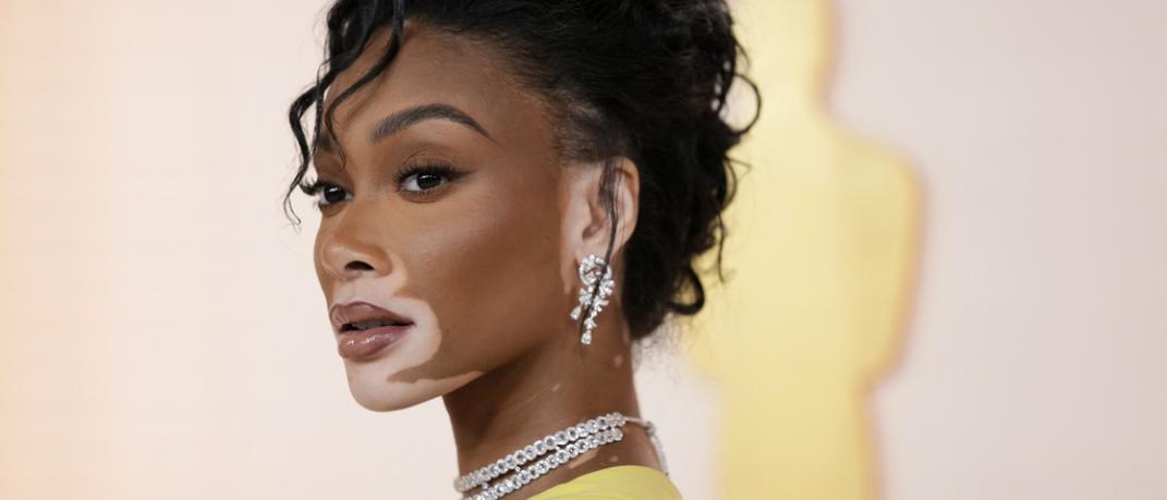 Oscar 2023, Winnie Harlow