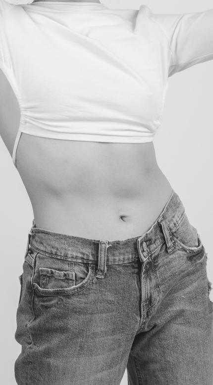 Επίπεδη κοιλιά 