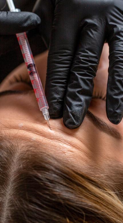 Botox: Γιατί το αποτέλεσμα των ενέσεων μπορεί να διαφέρει από γιατρό σε γιατρό