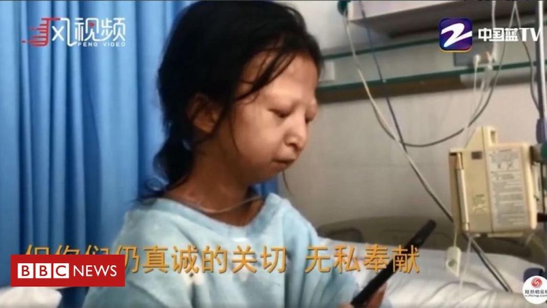 Νεκρή Κινέζα φοιτήτρια πέθανε από υποσιτισμό 