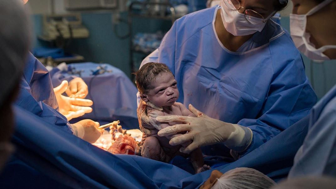 Νεογέννητο μωρό κοιτά με αστεία έκφραση τον γιατρό