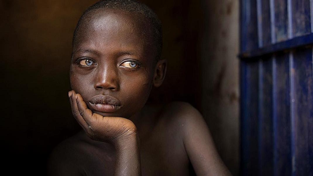 παιδί από το Νότιο Σουδάν