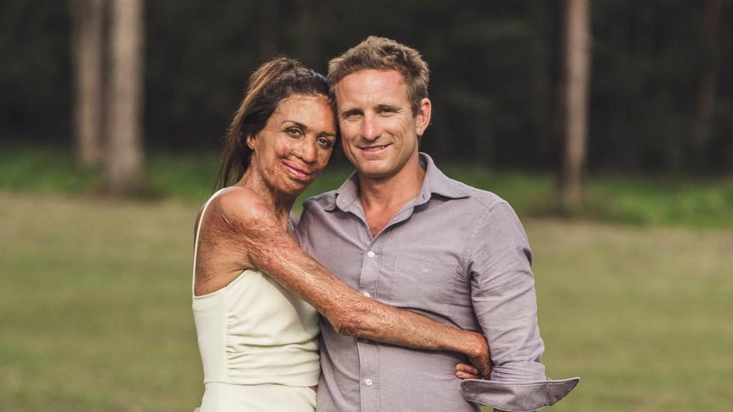 turia pitt