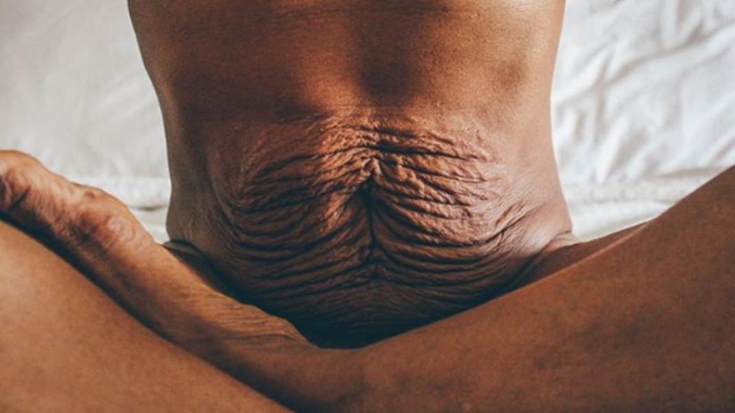 Καθηγήτρια γιόγκα ποστάρει τη γεμάτη πιέτες από τη χαλάρωση κοιλιά της στο Instagram -«Αγαπήστε το σώμα σας»  | 0 bovary.gr