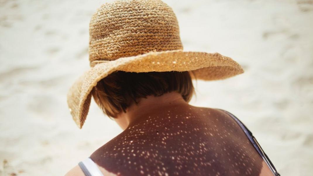 Κορίτσι με καπέλο στον ήλιο/Photo by Meg Sanchez on Unsplash
