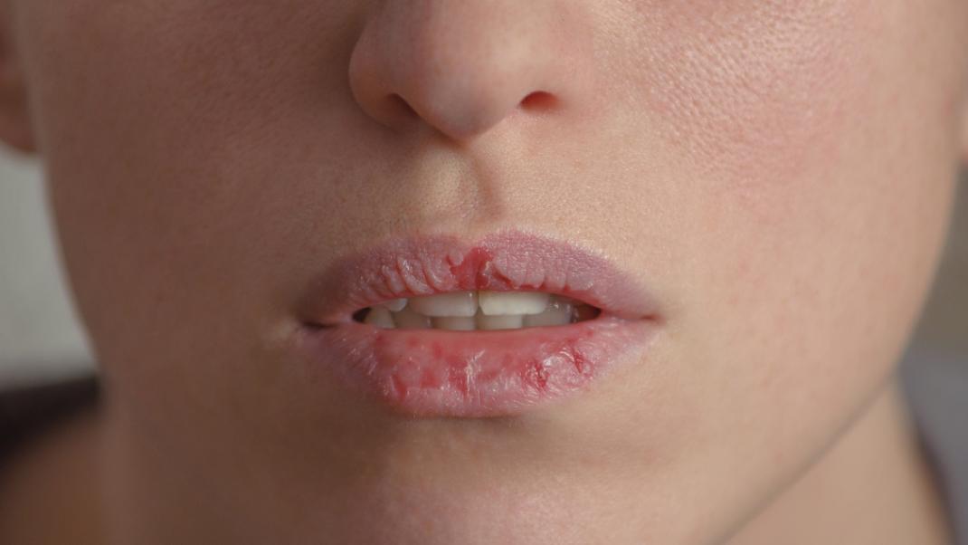 Μια γυναίκα δαγκώνει τα χείλη της, Φωτογραφία: Shutterstock/By Tetiana Mandziuk