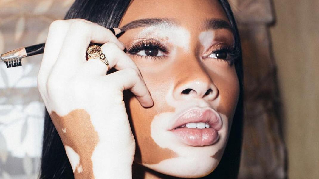 Instagram/Winnie Harlow