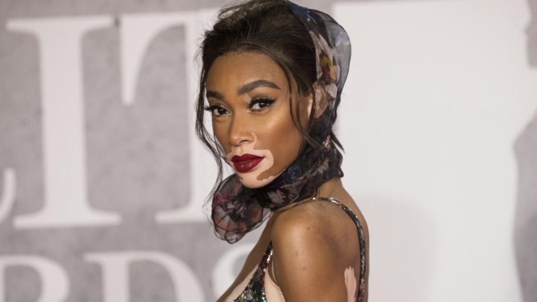 H Winnie Harlow στα Brit Awards, Φωτογραφία: ΑP images/Vianney Le Caer