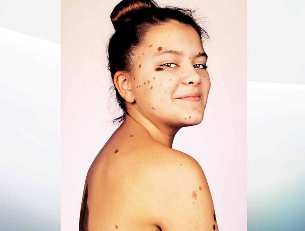 Φωτογραφία: Brock Elbank