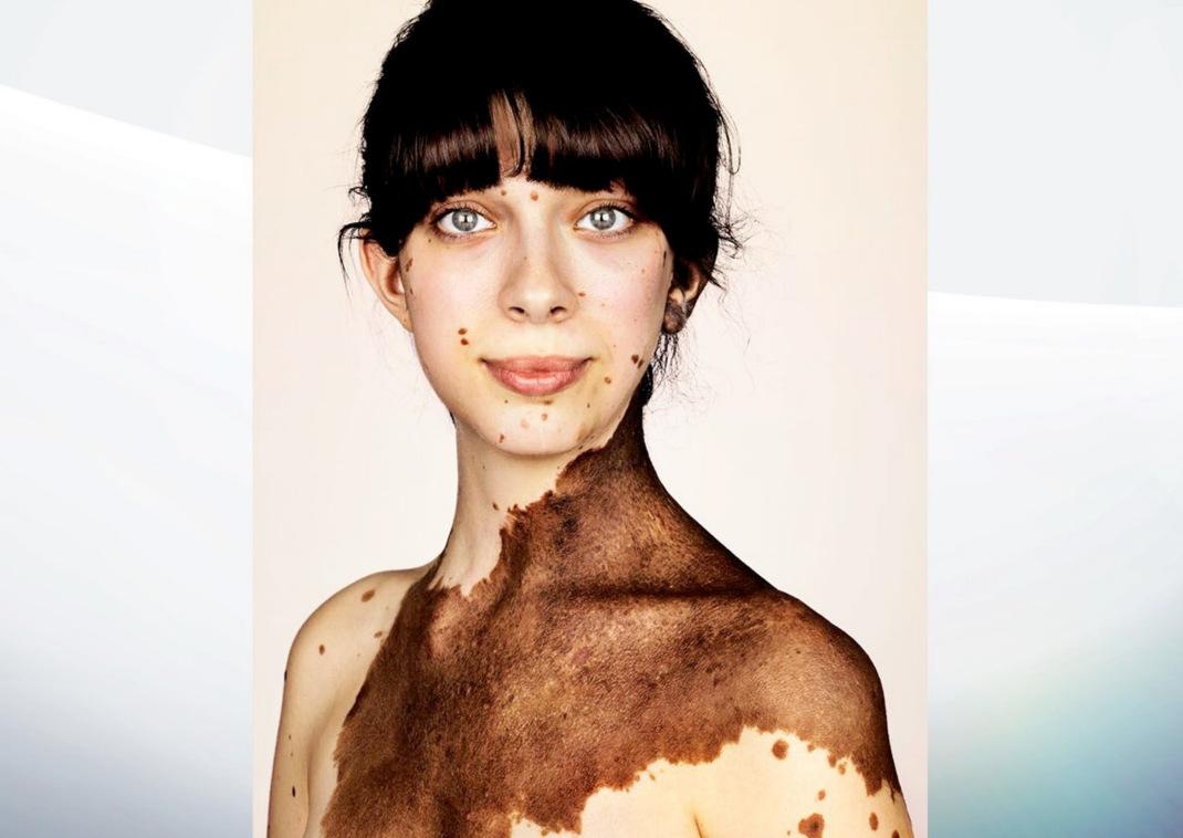 Φωτογραφία: Brock Elbank