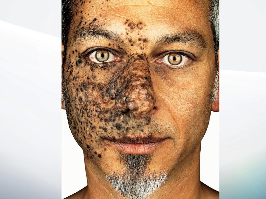 Φωτογραφία: Brock Elbank