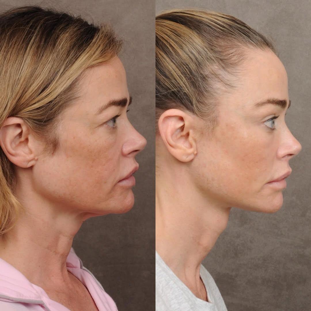 Φωτογραφία Instagram/Denise Richards
