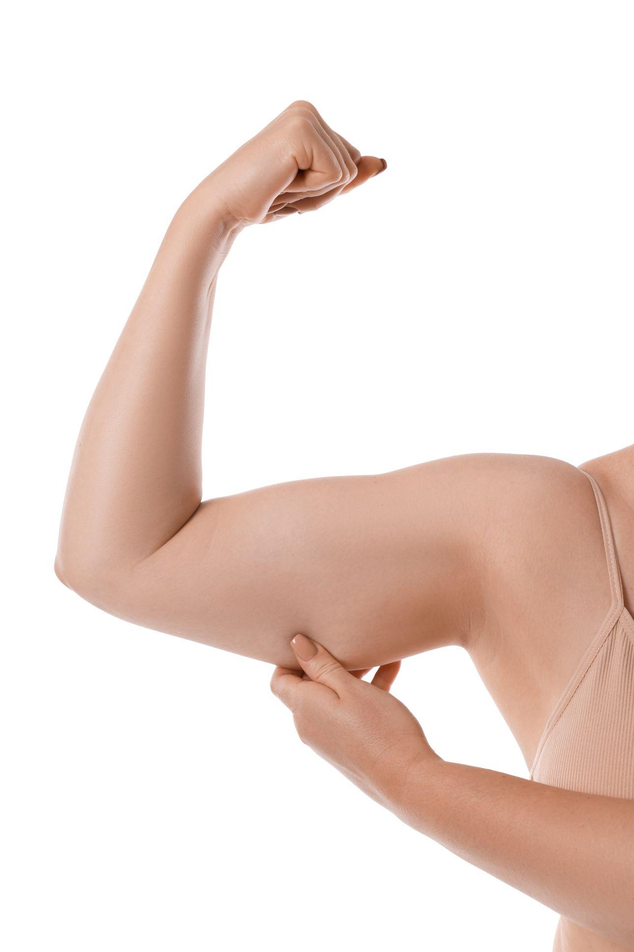 Η απώλεια λίπους στα μπράτσα απαιτεί ολοκληρωμένη προσέγγιση/ Φωτογραφία: Shutterstock 