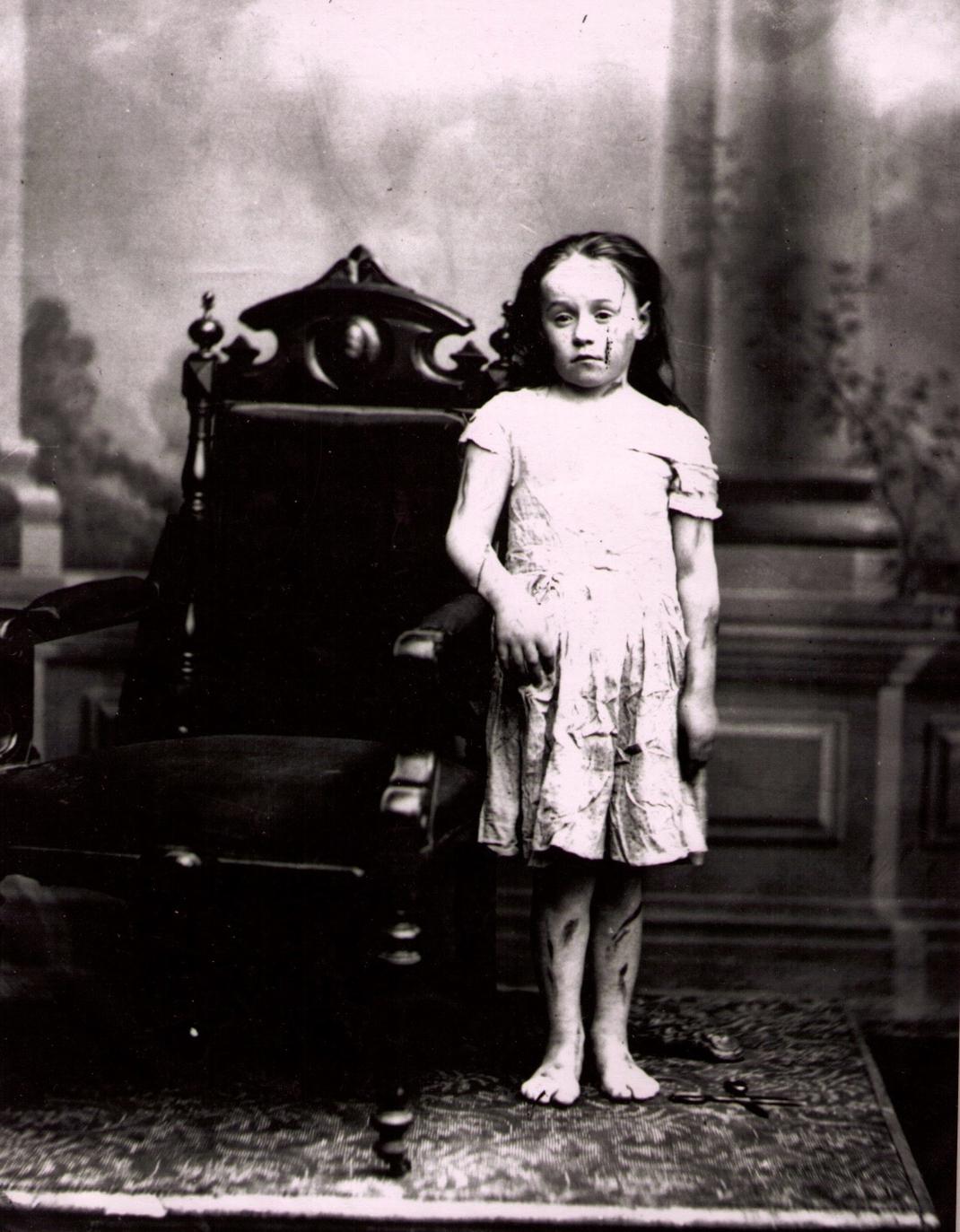 Φωτογραφία: George Sim Johnston Archives of the N.Y. Society for the Prevention of Cruelty to Children