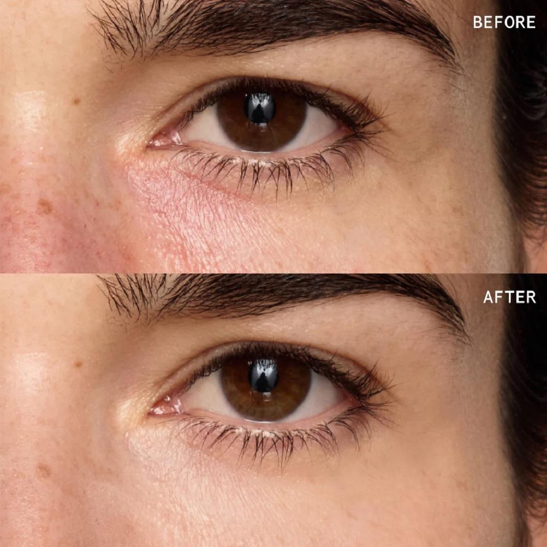 Μείωση πρηξίματος με Under Eye Brightening Duo της Beauty Pie