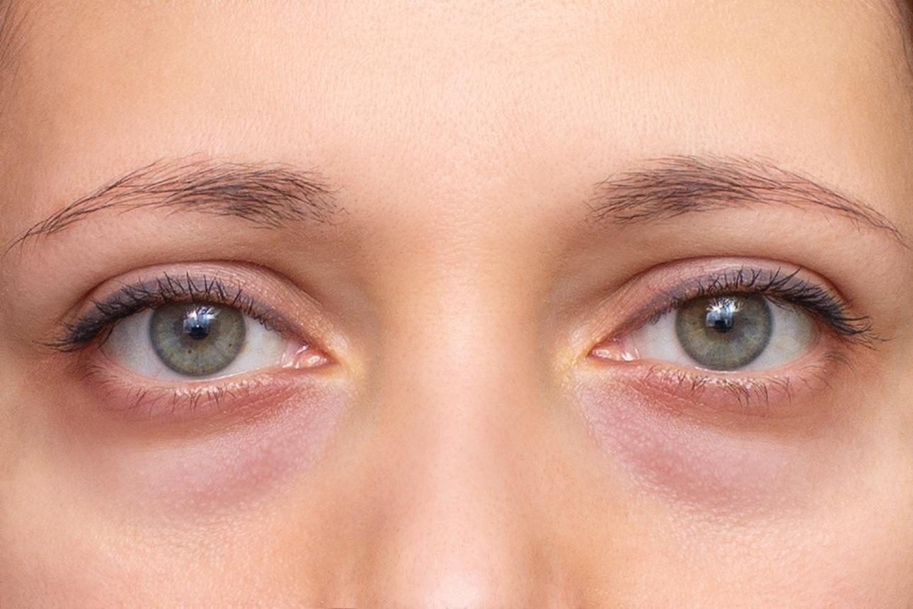 Φωτογραφία: Shutterstock