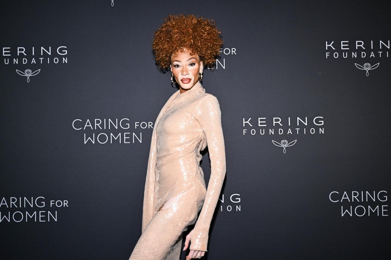 Winnie Harlow/Φωτογραφία: AP Photo 