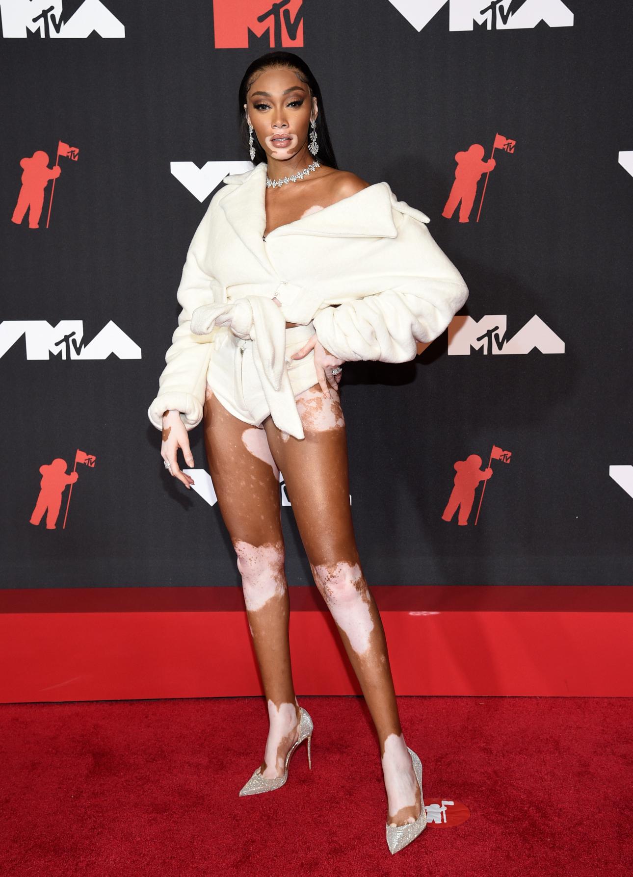  Winnie Harlow/Φωτογραφία: AP Photo