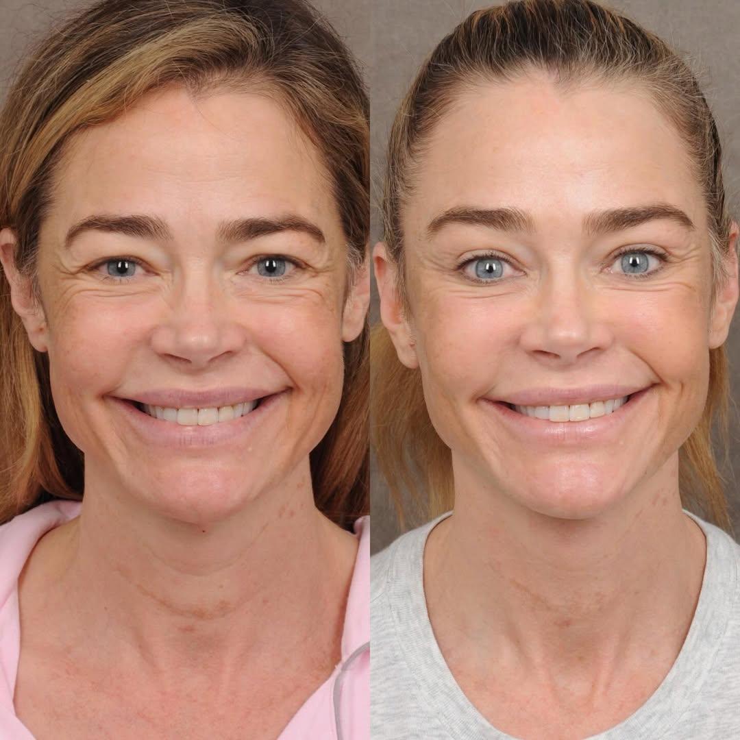 Φωτογραφία Instagram/𝐁𝐞𝐧 𝐓𝐚𝐥𝐞𝐢, 𝐌𝐃 Facial plastic Surgeon