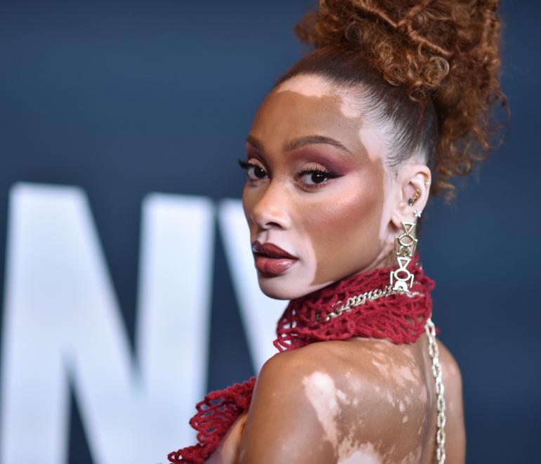 H Γουίνι Χάρλοου