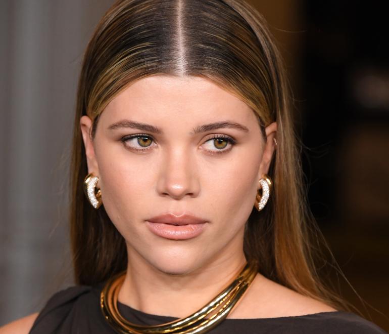 Η νέα beauty εμμονή λέγεται «Resting Rich Face» -Και υπόσχεται ξεκούραστη όψη, σαν μετά από διακοπές