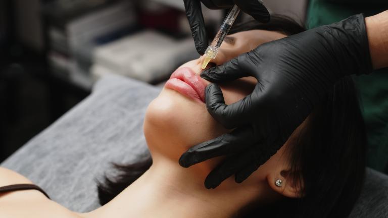 Fillers: Όταν η ομορφιά χάνει το μέτρο -Πού σταματά η αισθητική και πού ξεκινά η υπερβολή;