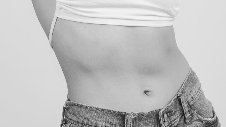 Επίπεδη κοιλιά 