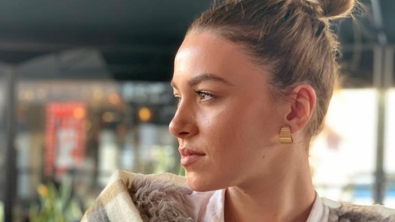 Ποια είναι η Εβελίνα Σκίτσκο: Το μοντέλο του GNTM που μίλησε ανοιχτά για τη διάγνωσή του με καρκίνο