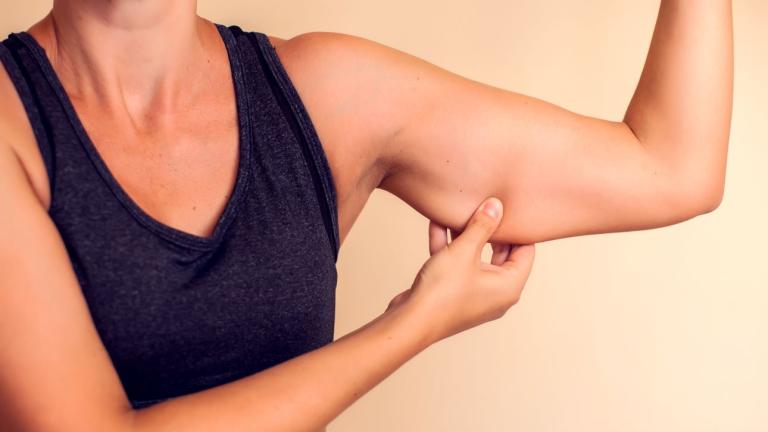 Τι να κάνετε για το λίπος στα μπράτσα