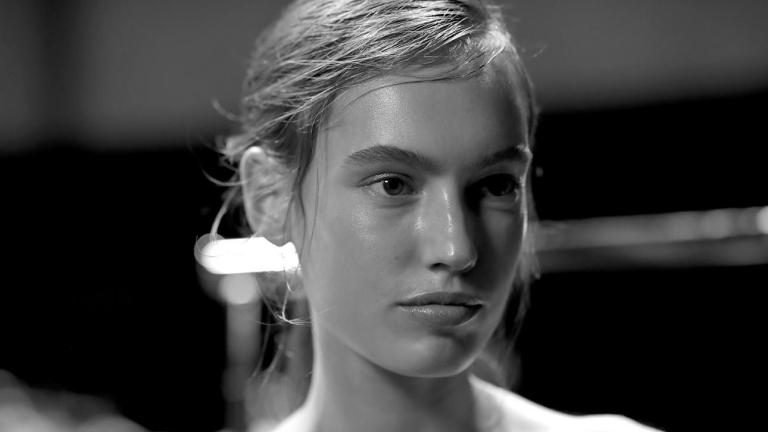 Οι καφέ κηλίδες που εμφανίζονται μετά τα 35: Πώς θα προστατεύσετε λαιμό και στήθος