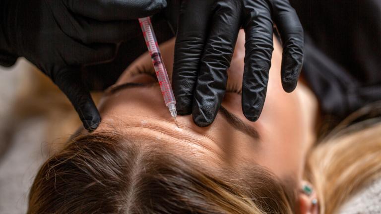 Botox: Γιατί το αποτέλεσμα των ενέσεων μπορεί να διαφέρει από γιατρό σε γιατρό