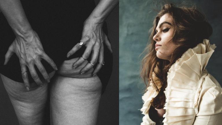 Μοντέλο ανεβάζει στο Instagram φωτογραφία με κυτταρίτιδα και απελευθερώνεται | 0 bovary.gr