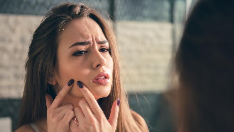 Γιατί δεν πρέπει να ξαναπειράξεις τα σπυράκια στο πρόσωπο, Φωτογραφία: Shutterstock/By George Rudy