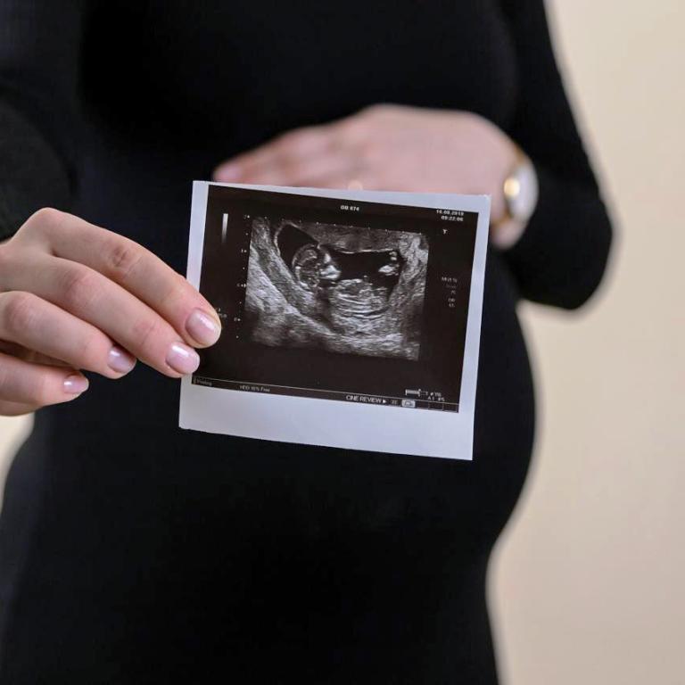 Πότε αρζίζει όντως να φθίνει η γονιμότητα;