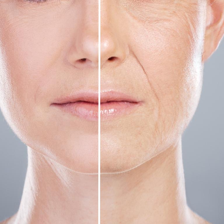 La Roche Posay – Anti Aging (HYALU B5 EYE SERUM, REDERMIC [R] EYES)