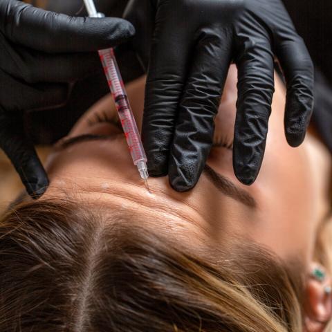 Botox: Γιατί το αποτέλεσμα των ενέσεων μπορεί να διαφέρει από γιατρό σε γιατρό